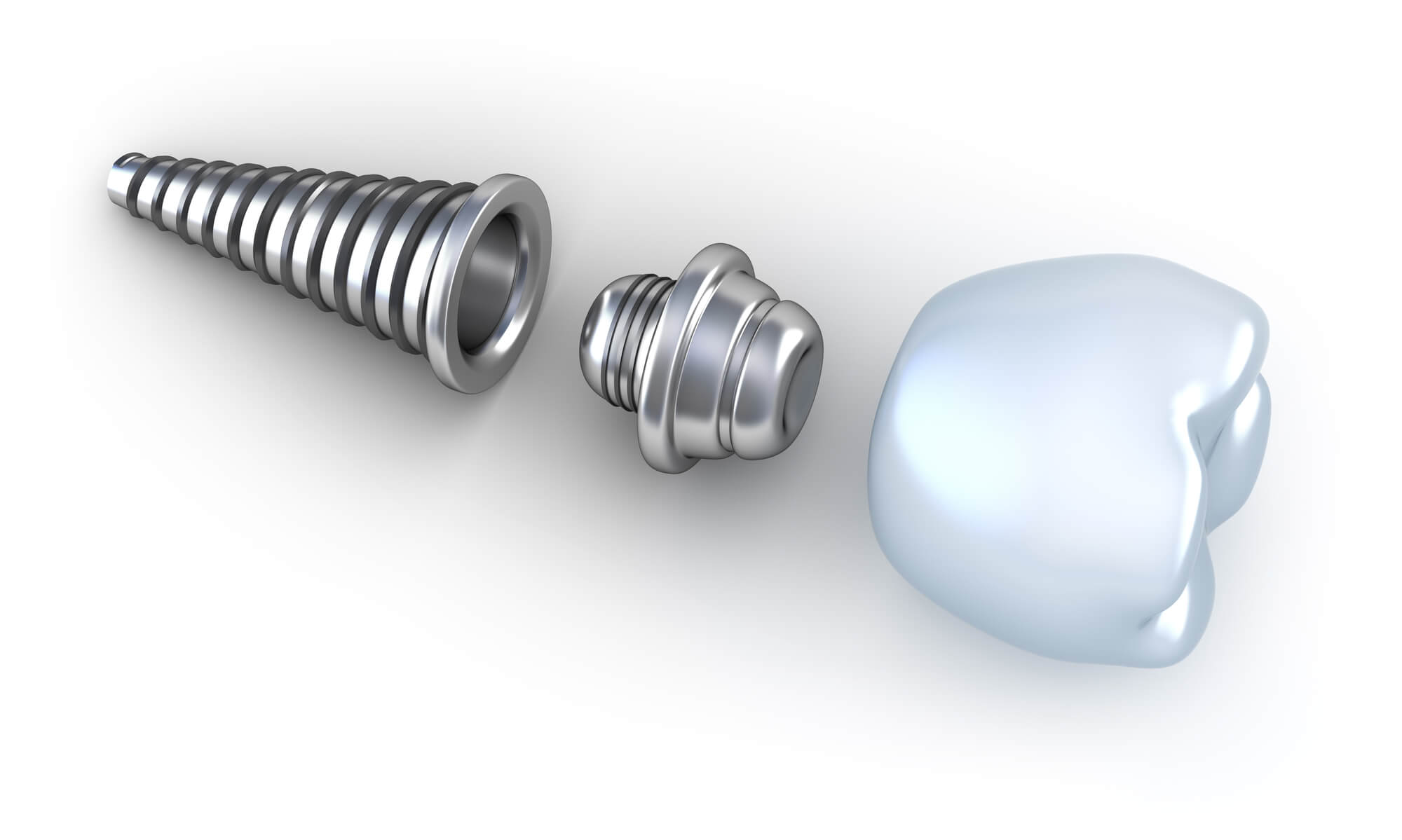 where is the best dental implants port st lucie?
